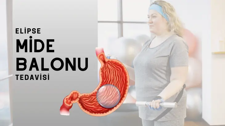 Yutulabilir Balon Teknolojisinin Marka Boyutu Allurion Mide Balonu