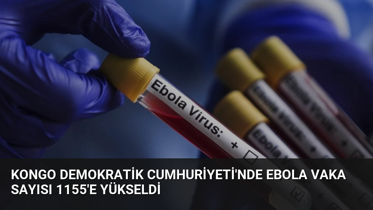 Kongo Demokratik Cumhuriyeti’nde Ebola Vaka Sayısı 1155’e Yükseldi