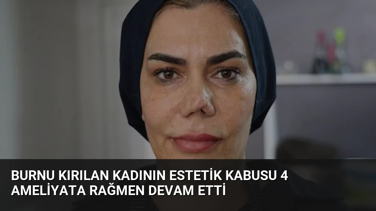Burnu Kırılan Kadının Estetik Kabusu 4 Ameliyata Rağmen Devam Etti